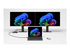 Microsoft Surface Laptop Copilot+ PC for Business