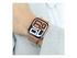 Vonmählen Milanese Loop 2